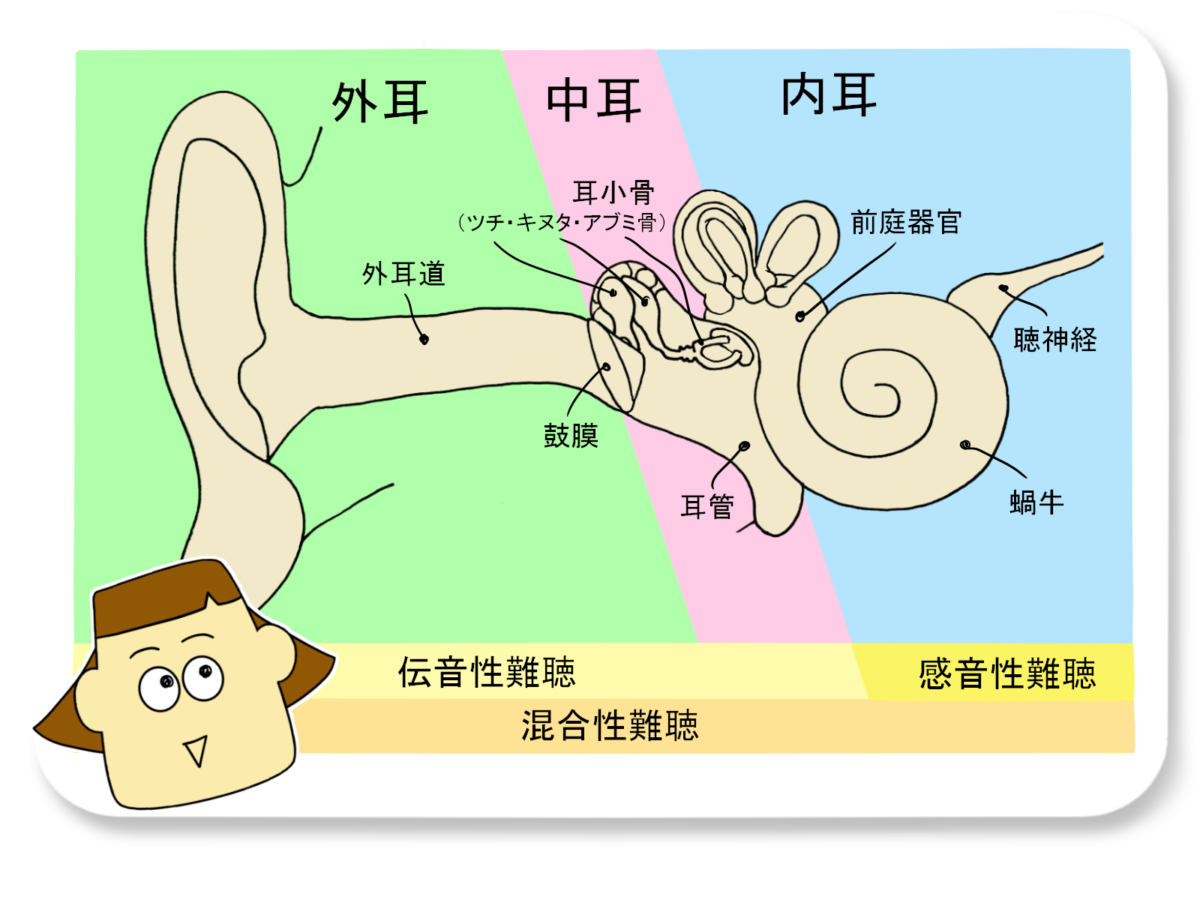 難聴の種類と原因 伝音難聴 補聴器専門店ミラックス 茅ヶ崎店