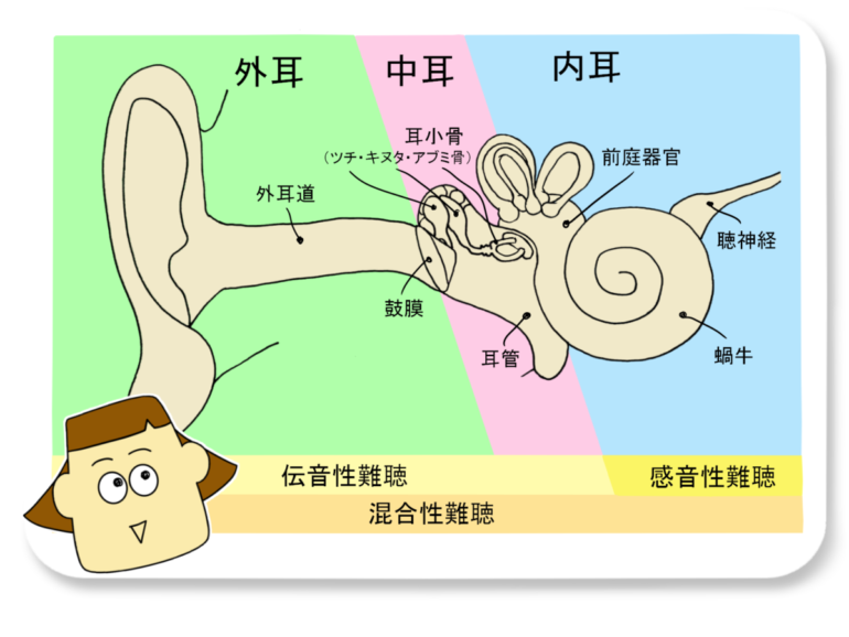 難聴の種類と原因【感音難聴】 - 補聴器専門店ミラックス｜茅ヶ崎店