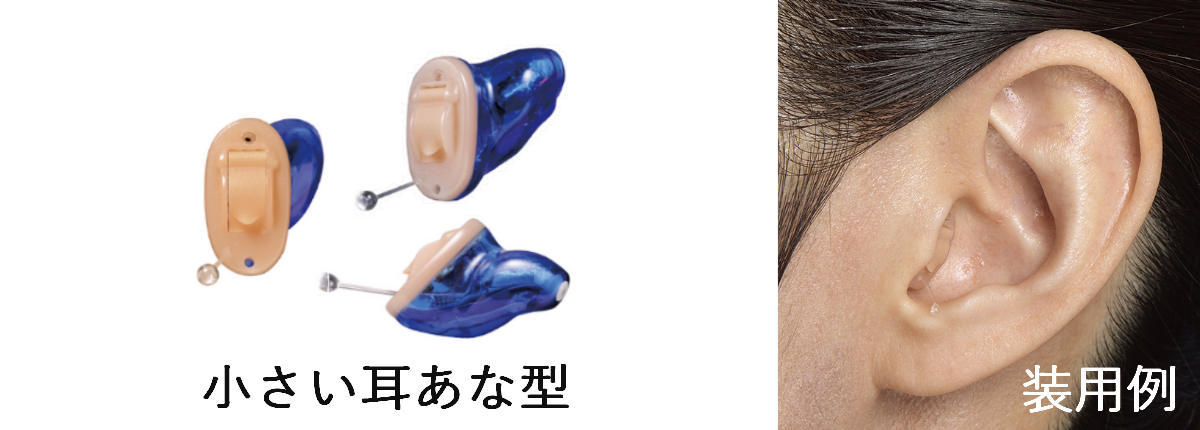 耳あな型補聴器と装用例