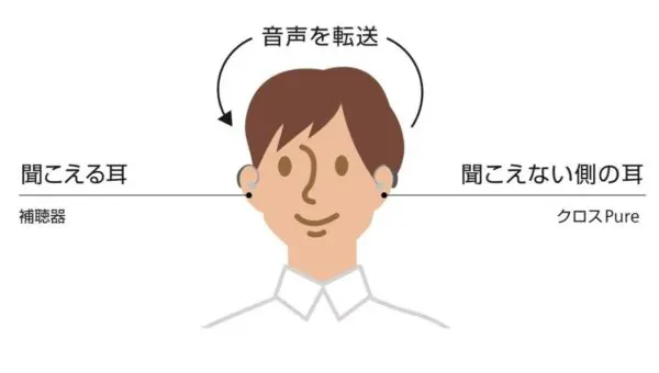 片耳難聴の人のためクロス補聴器とは 補聴器専門店ミラックス 茅ヶ崎店