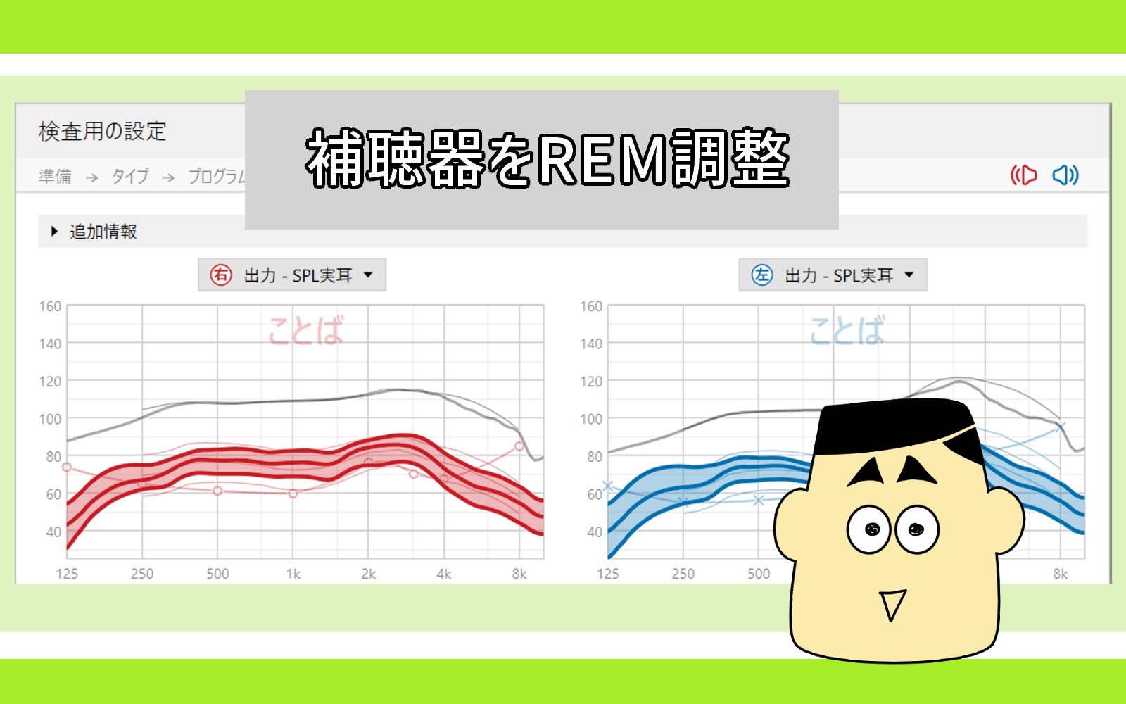 みみ様　確認用 フォナック補聴器を実耳測定で再調整、お客様の反応は？ - 補聴器専門