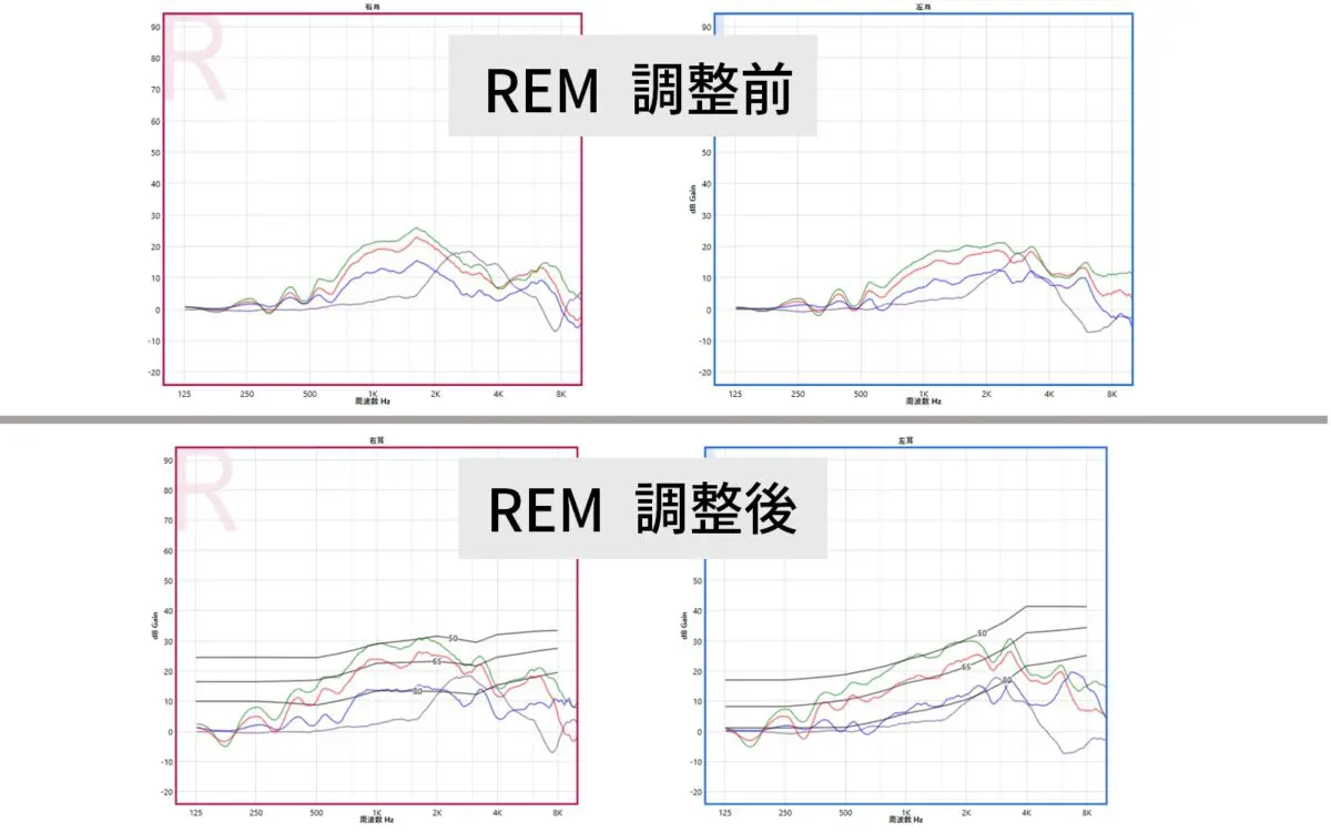 フォナック補聴器を実耳測定で再調整、お客様の反応は？ - 補聴器専門
