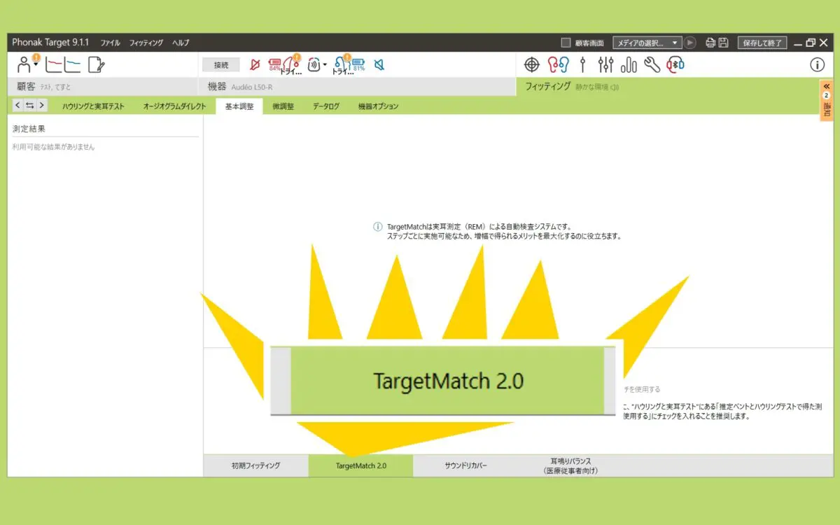 時間短縮＆正確な補聴器設定】フォナック補聴器・実耳測定ターゲット