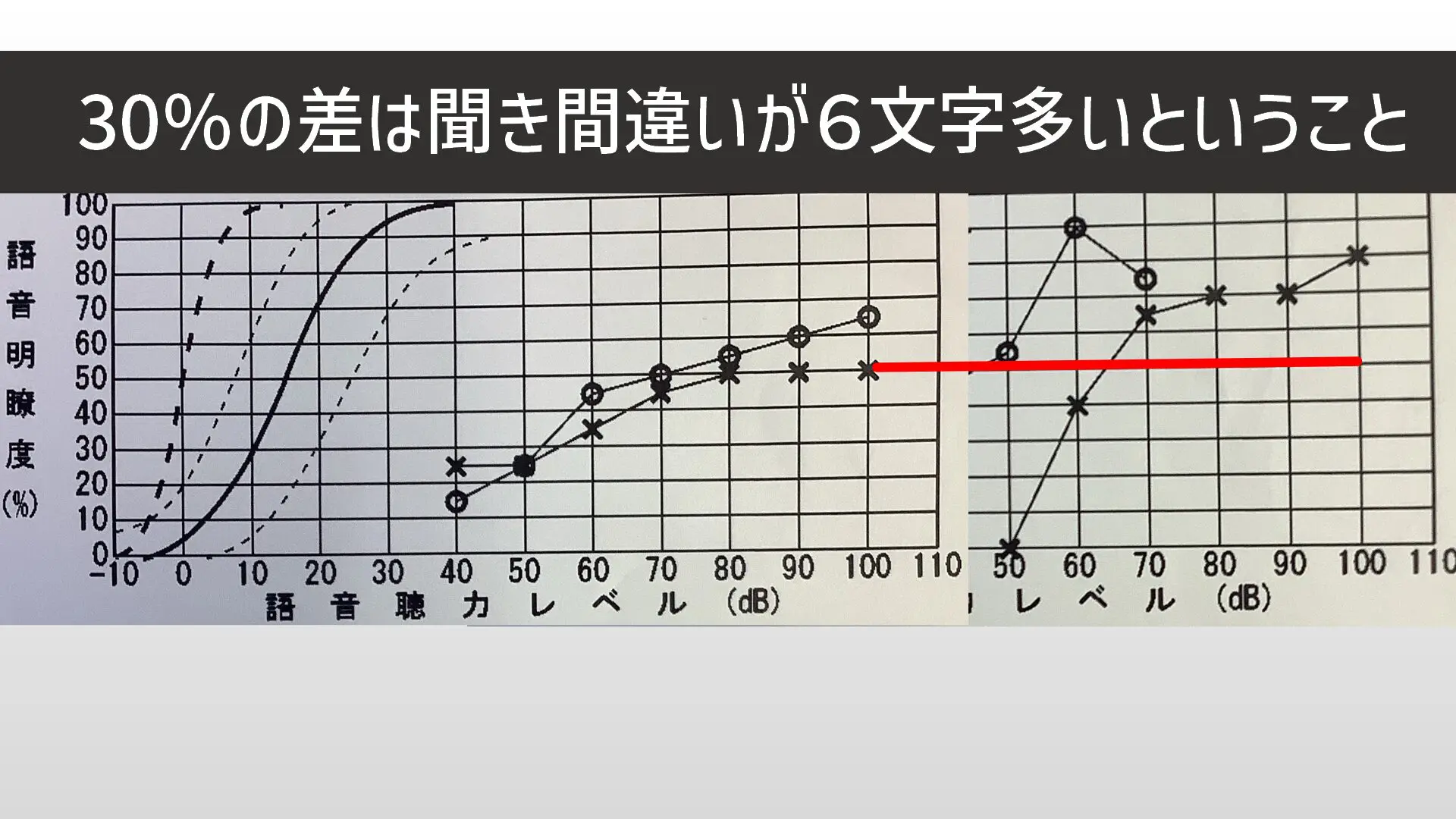 4つの視点】補聴器を使っているのに聞こえにくい！【理由と解決策